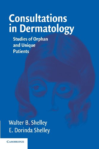 Consultations in Dermatology: Studies Of Orphan And Unique Patients von Cambridge University Press